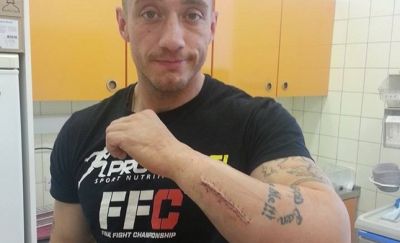 Chorchyp breaks his forearm in the match at FFC 14!